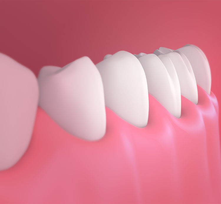 Treatment - Gloucester dental