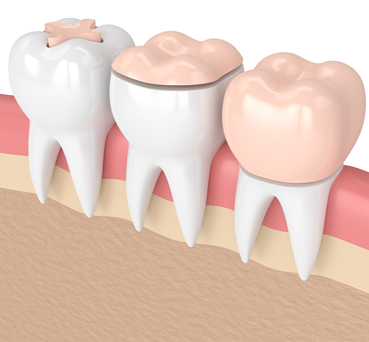 Treatment - Gloucester dental